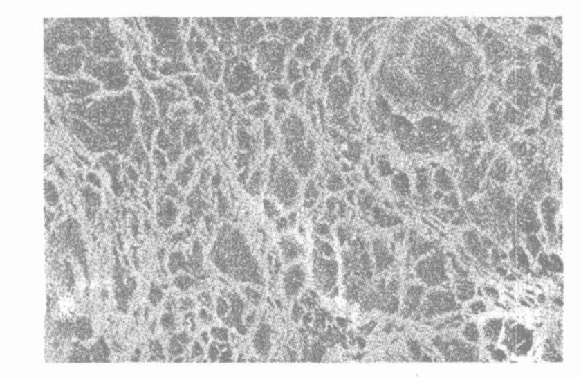 斷裂原因檢測|斷裂失效測試|開裂失效分析|開裂原因分析